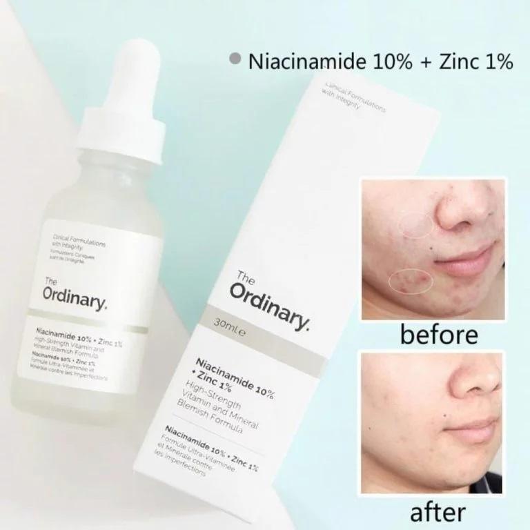 The Ordinary Niacinamide 10% + Zinc 1% - Iconic and class